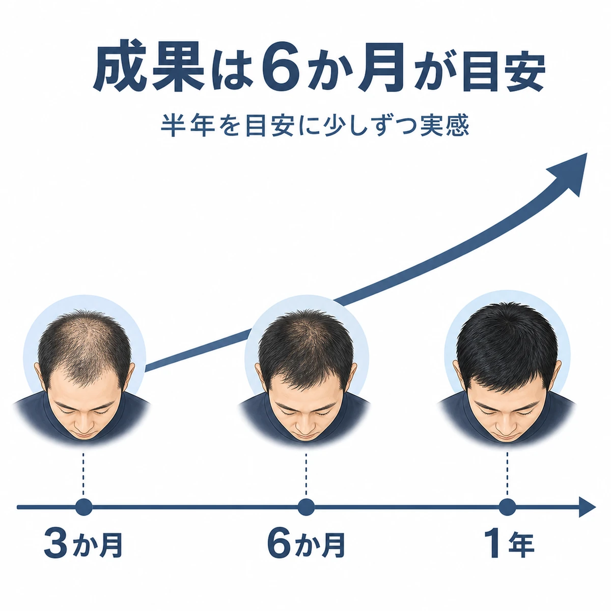 育毛の成果が6か月を目安に右上がりで現れる経過を表した医療イラスト