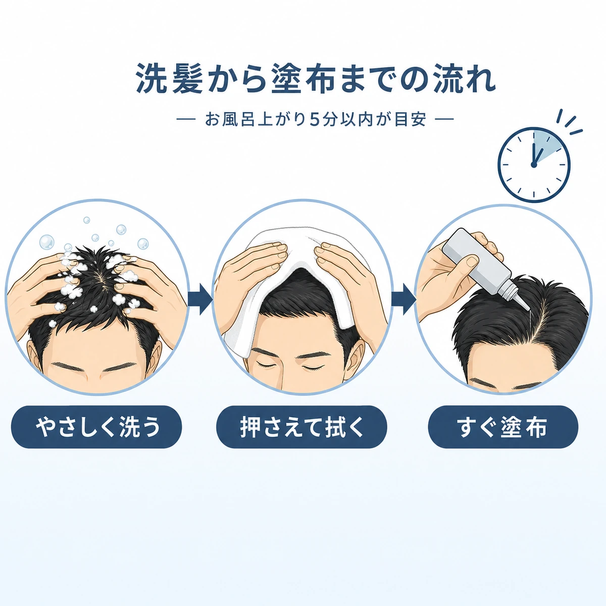 洗髪からタオルドライを経て育毛剤を塗布するまでの手順を段階で表した医療イラスト