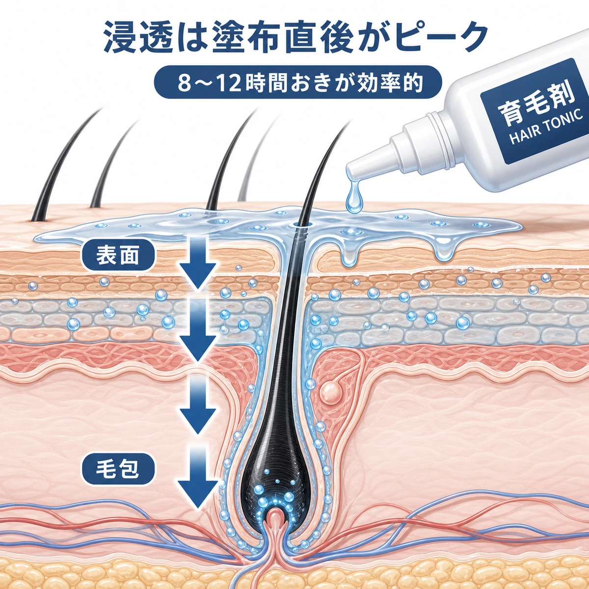 育毛剤が頭皮表面から毛包へ浸透する仕組みを表した医療イラスト