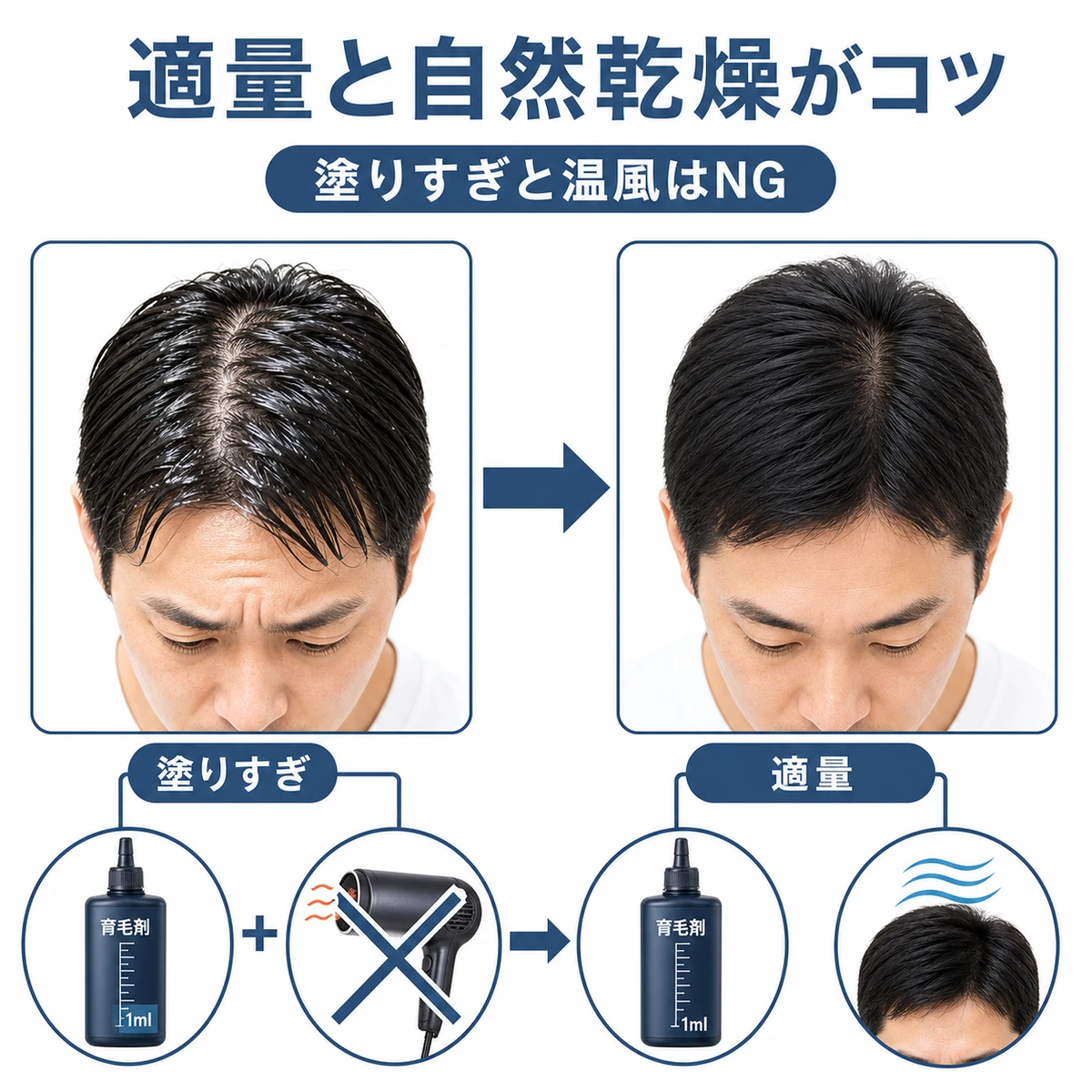 塗りすぎと乾かし方でベタつきが変わる育毛剤の塗り方を比べた医療イラスト