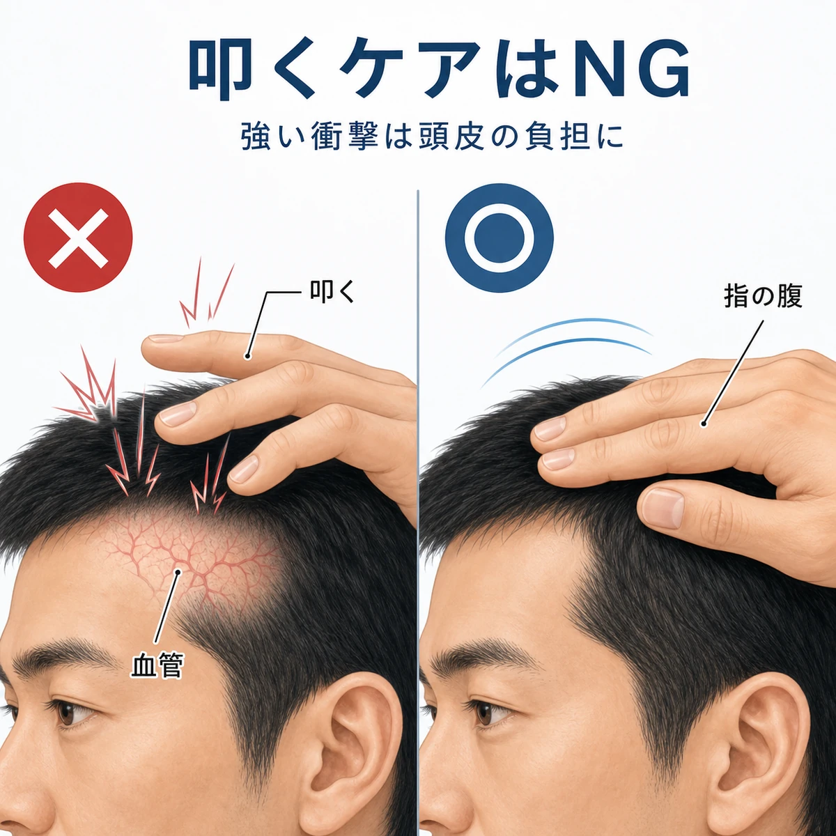 頭皮を叩くケアと指の腹で押さえるケアの違いを対比した育毛イラスト