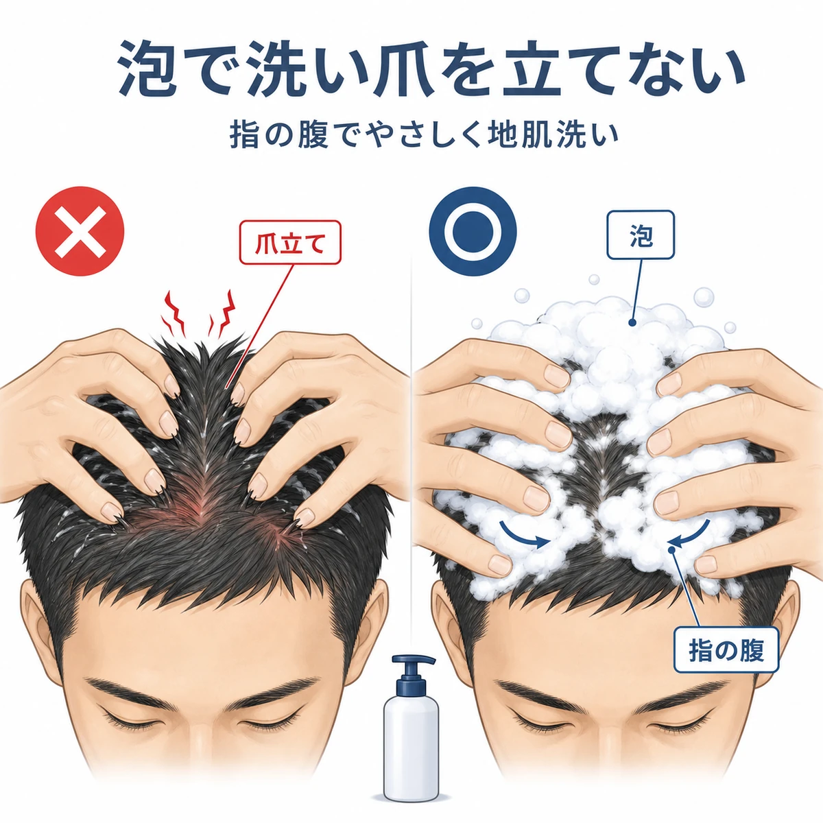 爪を立てる洗い方と泡と指の腹でやさしく洗う方法を対比した育毛イラスト