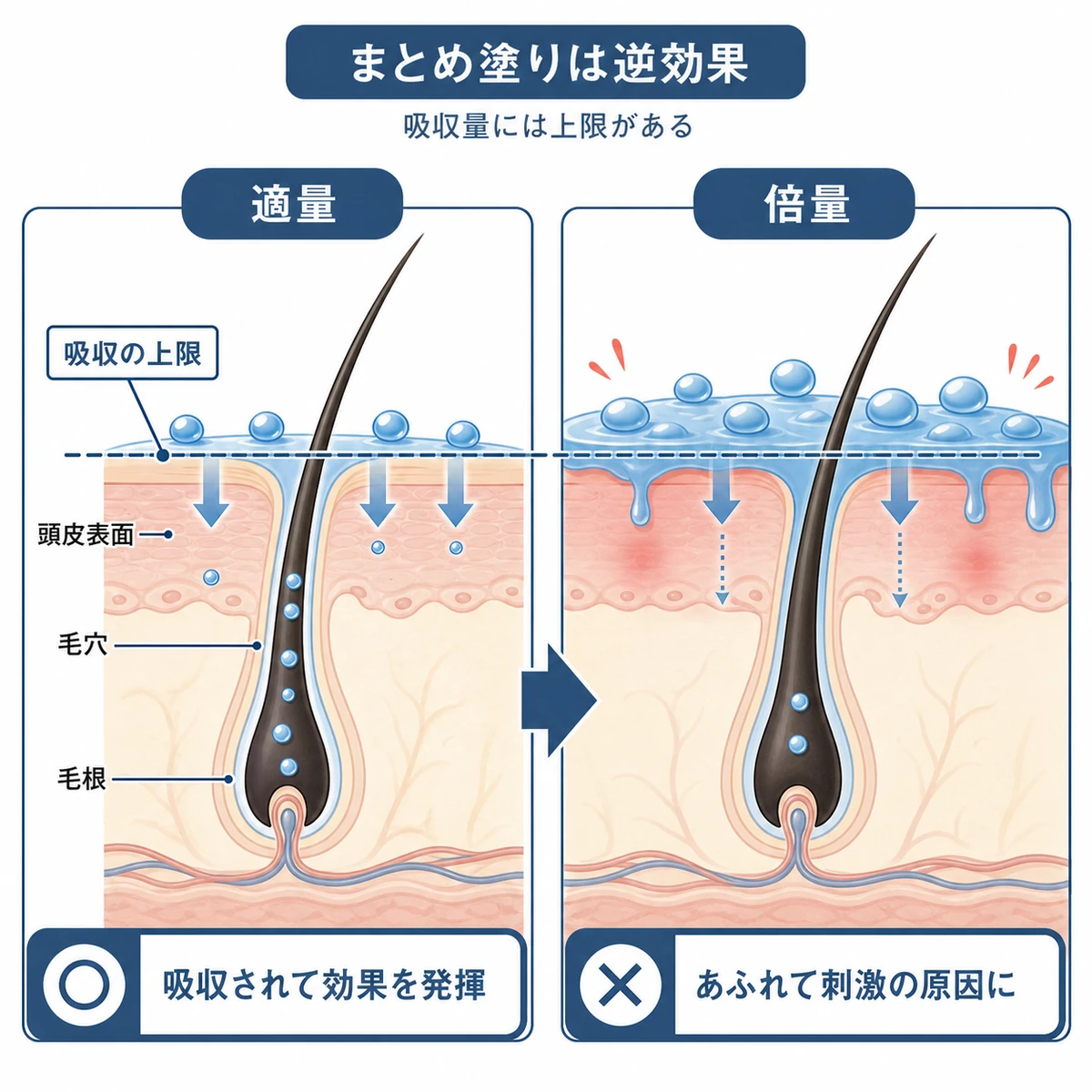 適量とまとめ塗りで頭皮の吸収と刺激がどう違うかを比べた医療イラスト