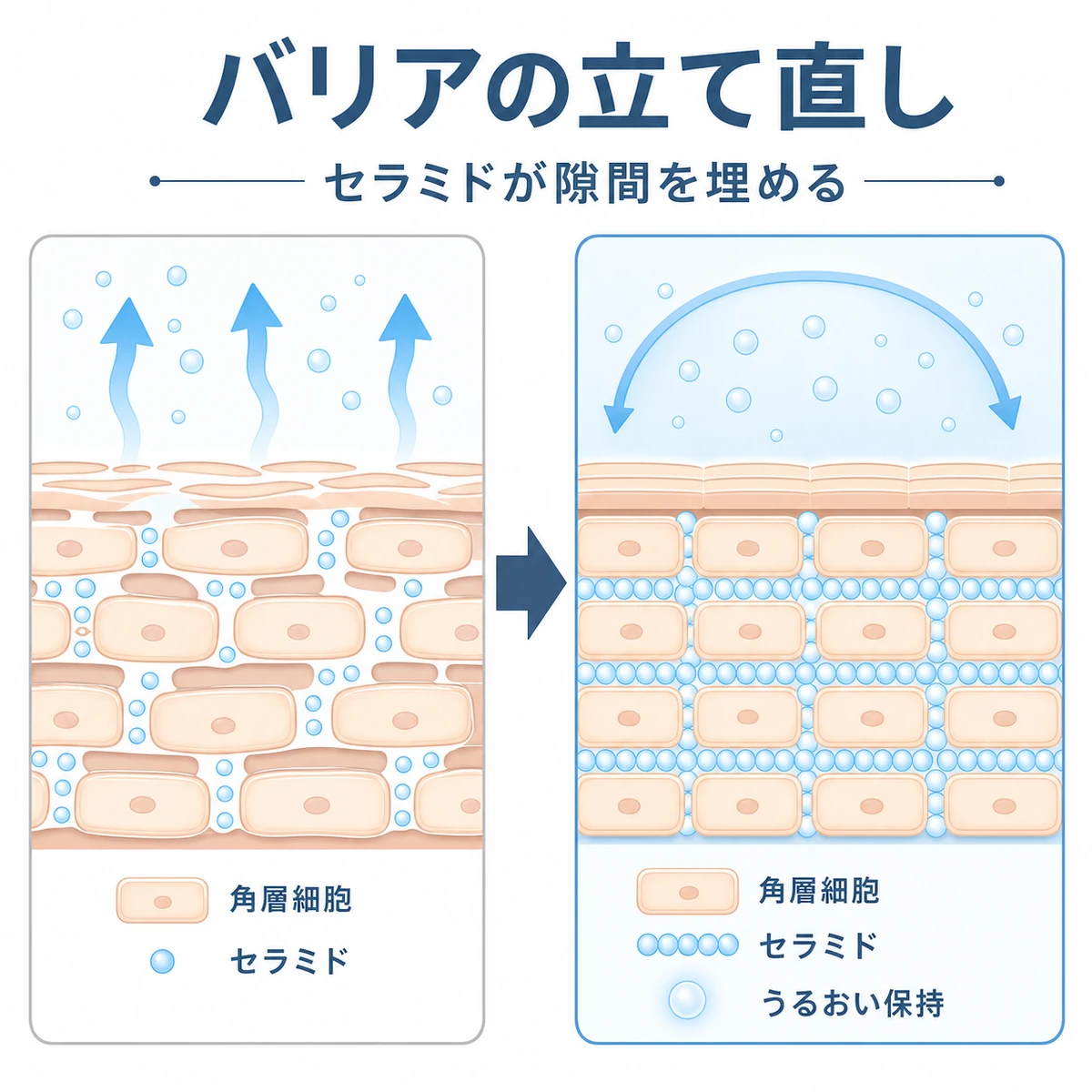 セラミドが角層の隙間を埋めてバリア機能を立て直す前後を表した医療イラスト