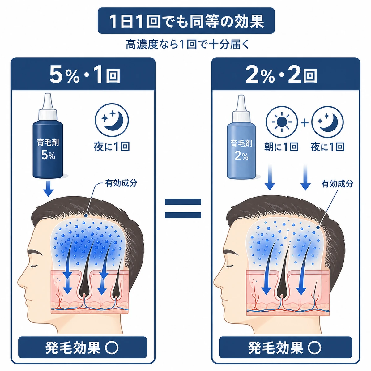 高濃度の1日1回と低濃度の1日2回が同等の発毛効果になることを対比した医療イラスト