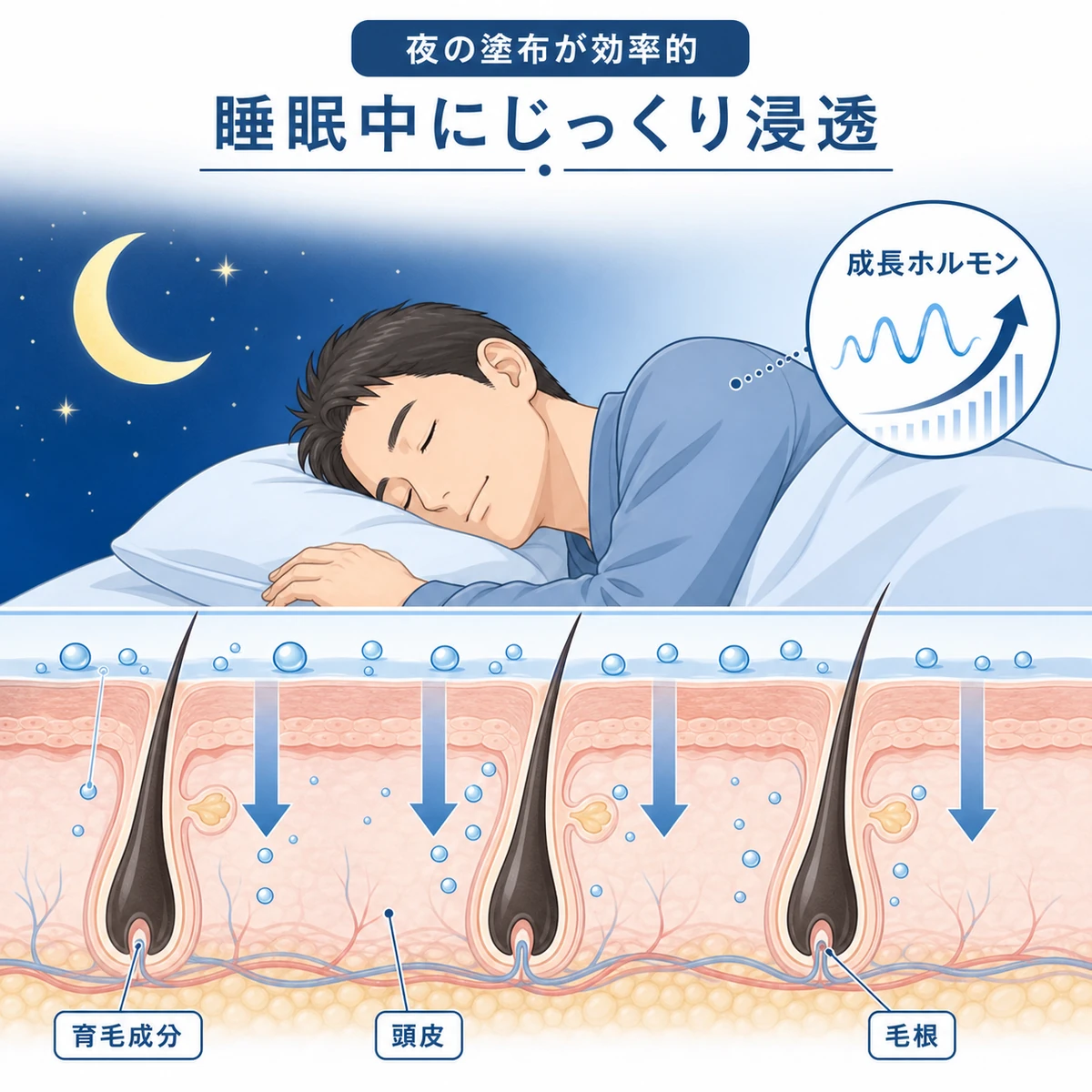 夜の就寝中に育毛剤の成分が頭皮へ下向きに浸透していく様子を表した医療イラスト