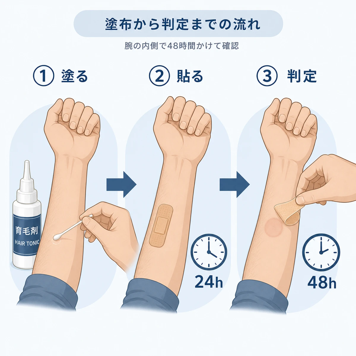 育毛剤のパッチテストを腕に塗ってから48時間後に判定するまでの手順を示した医療イラスト
