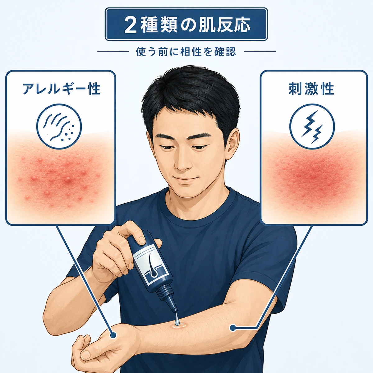 アレルギー性と刺激性という2種類の接触皮膚炎を対比した育毛剤パッチテストの医療イラスト
