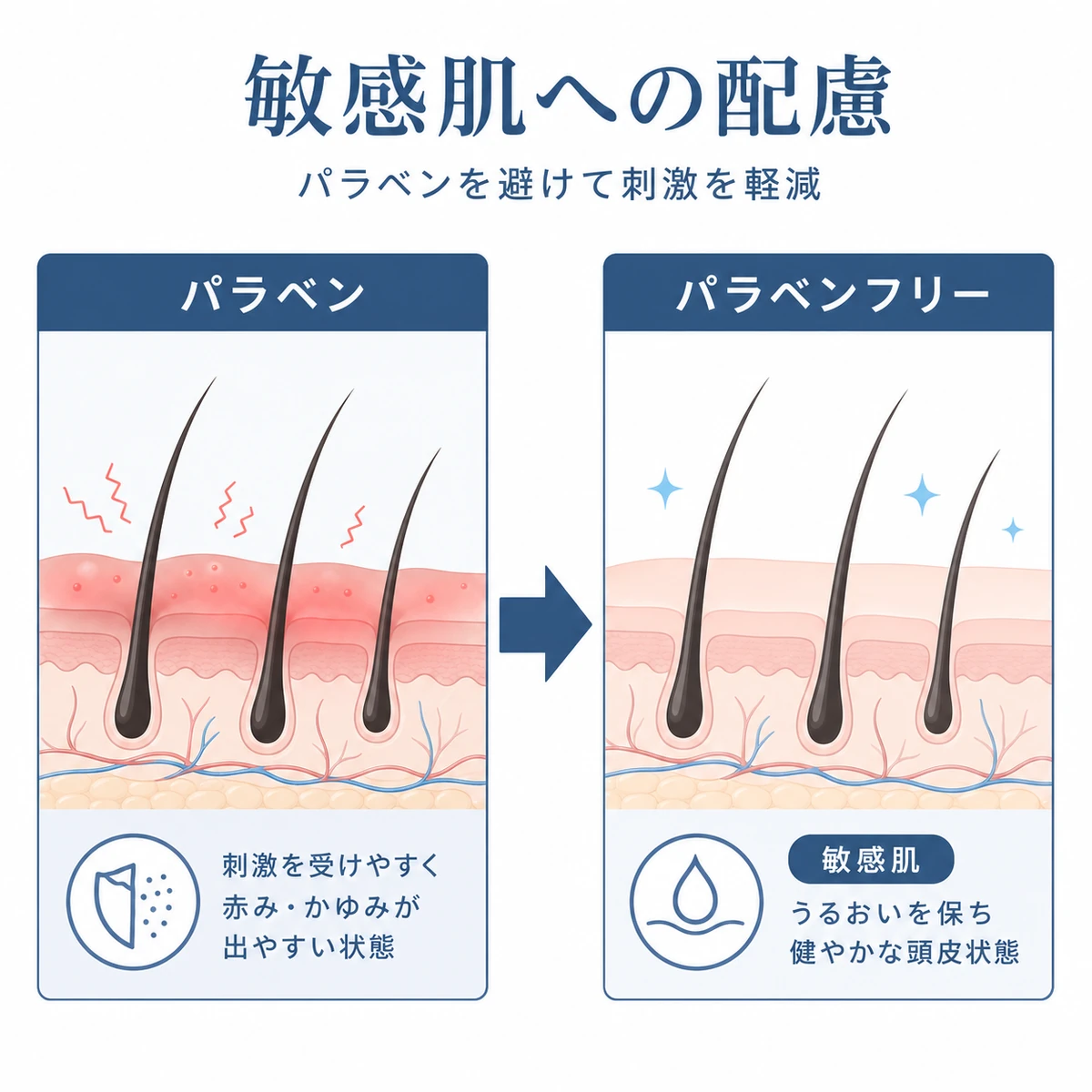 パラベンフリーに切り替えて敏感肌の頭皮の刺激が和らぐ変化を表した医療イラスト