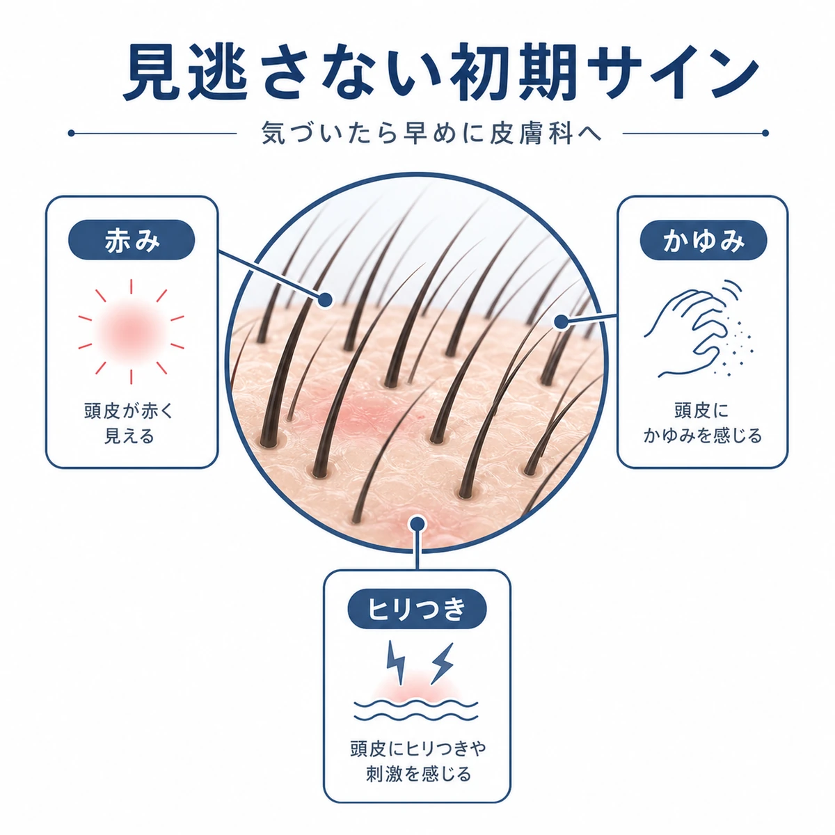 育毛剤による頭皮トラブルのかゆみや赤みなど初期サインを頭皮図で示した医療イラスト