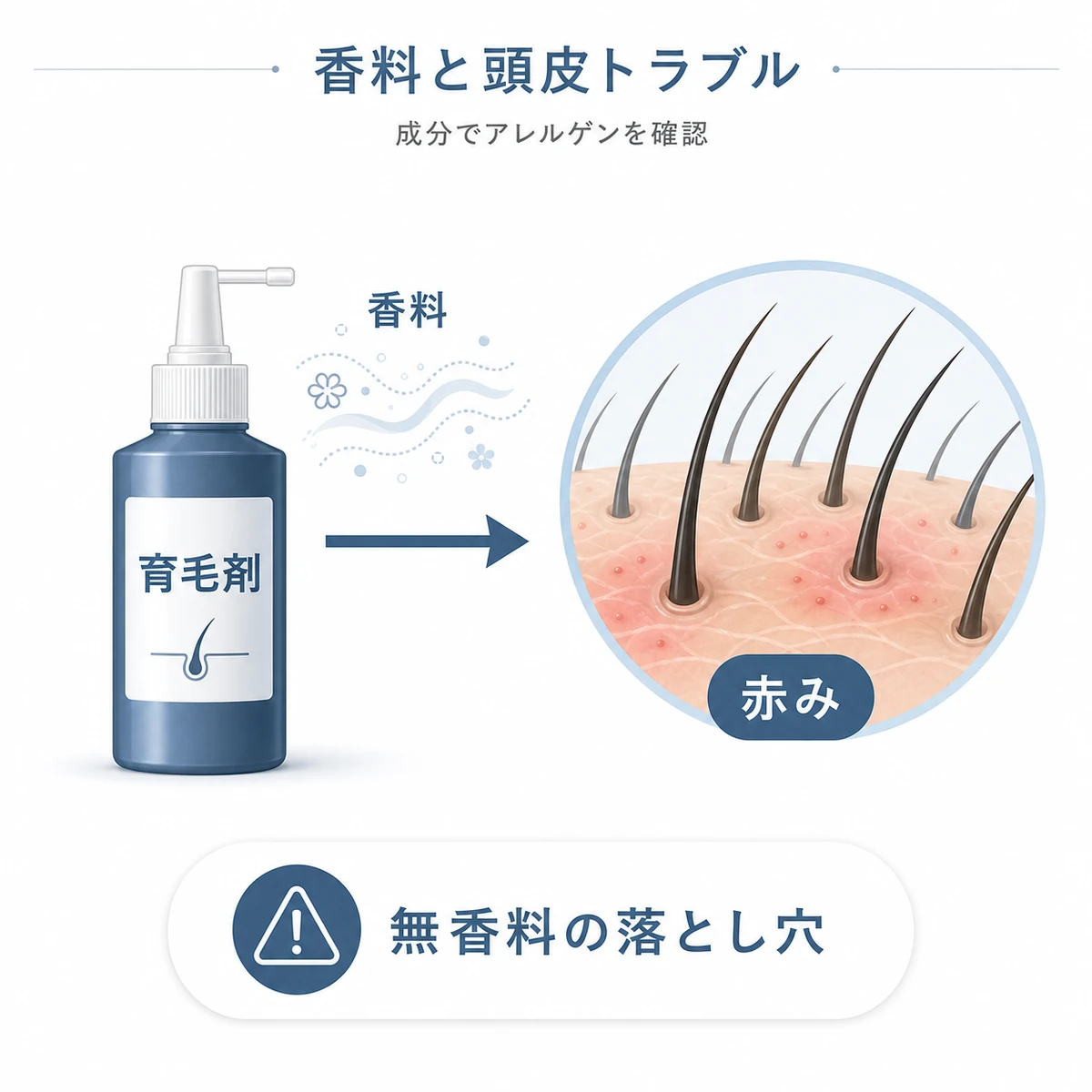 育毛剤の香料が頭皮の赤みやかゆみにつながる仕組みを表した医療イラスト