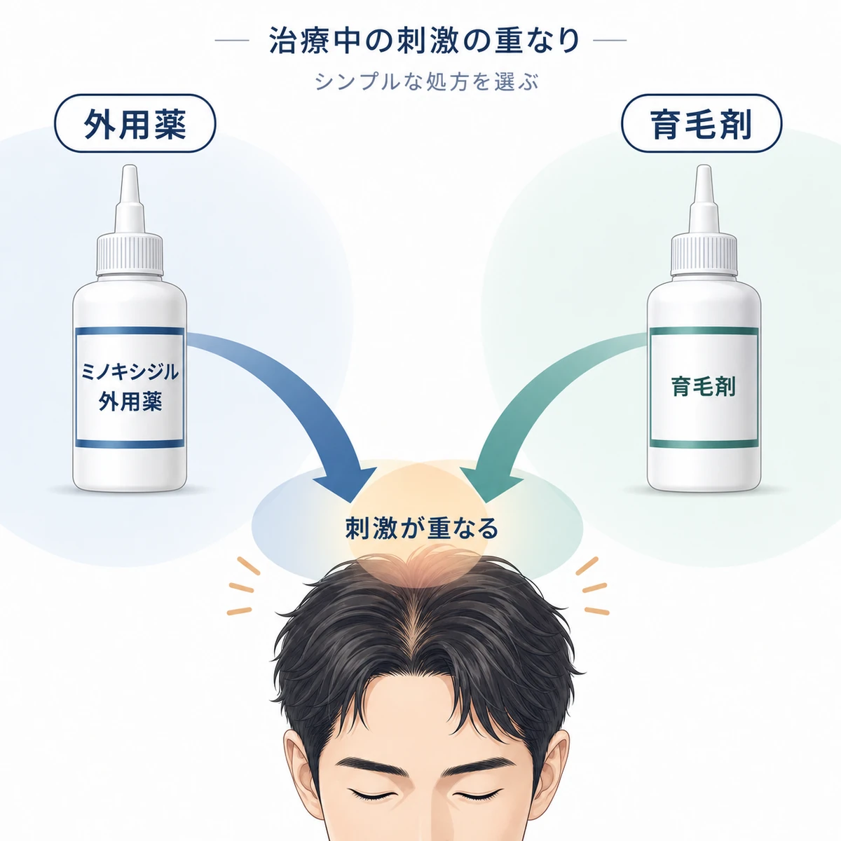AGA治療中に外用薬と育毛剤の刺激が頭皮で重なる注意点を表した医療イラスト