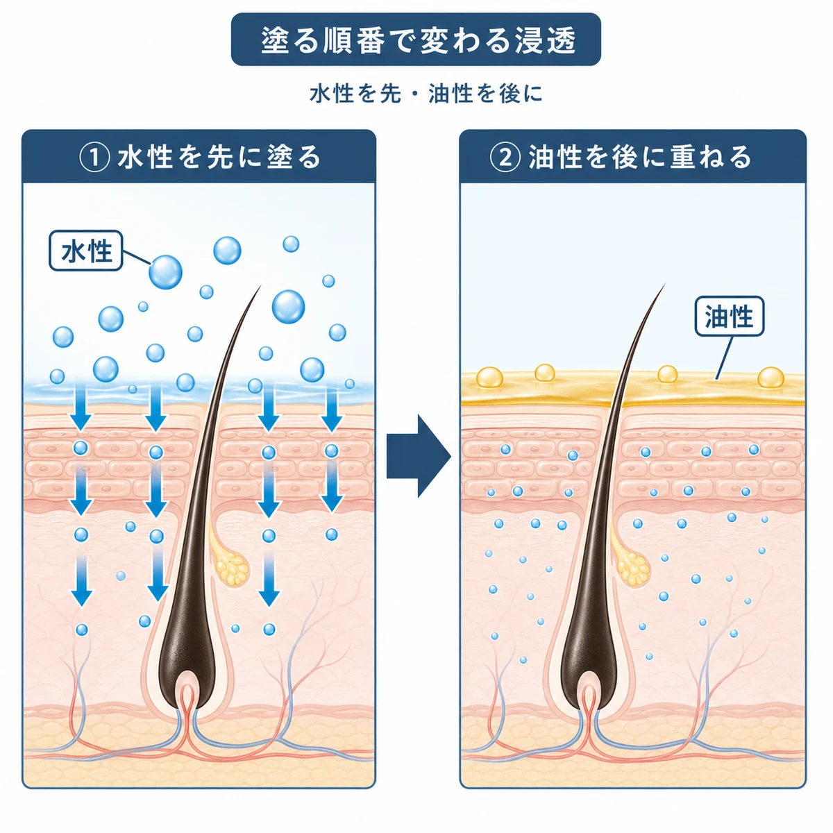 水性の育毛剤を先に油性を後に塗る正しい順番と浸透の流れを表した医療イラスト