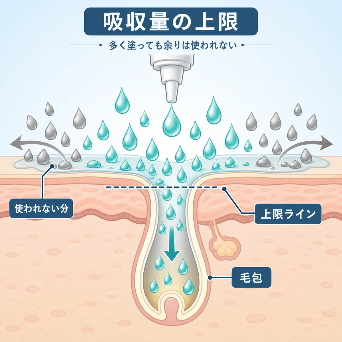 育毛剤の有効成分が毛包に取り込める量には上限があり超過分は使われないしくみを表した医療イラスト