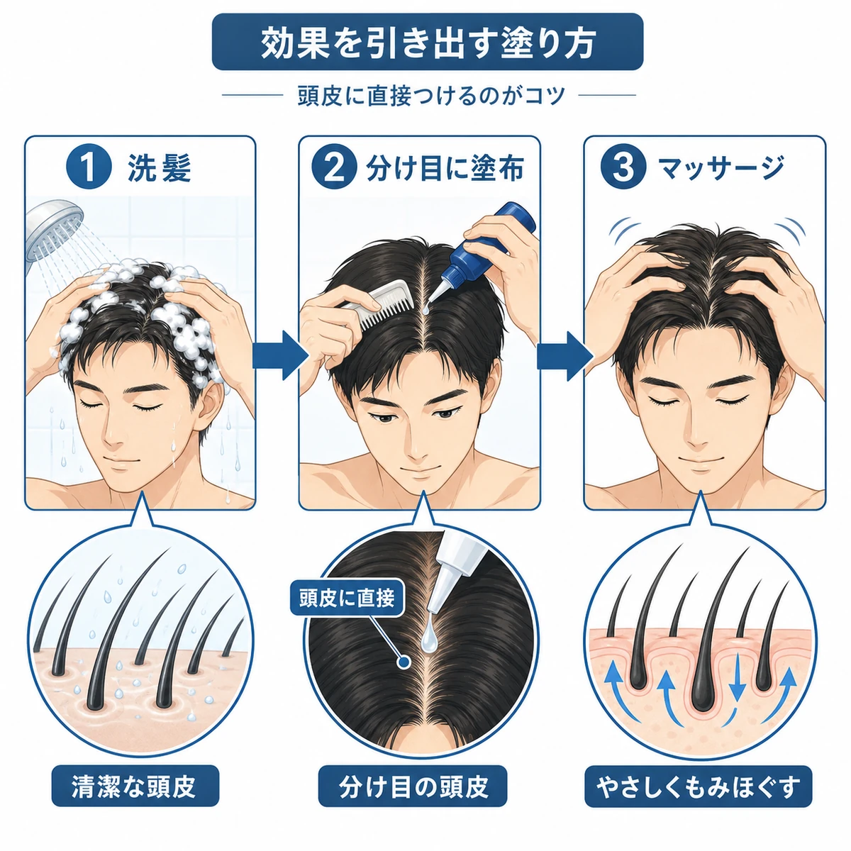 洗髪から分け目への塗布そしてマッサージまでの正しい育毛剤の塗り方の手順を表した医療イラスト