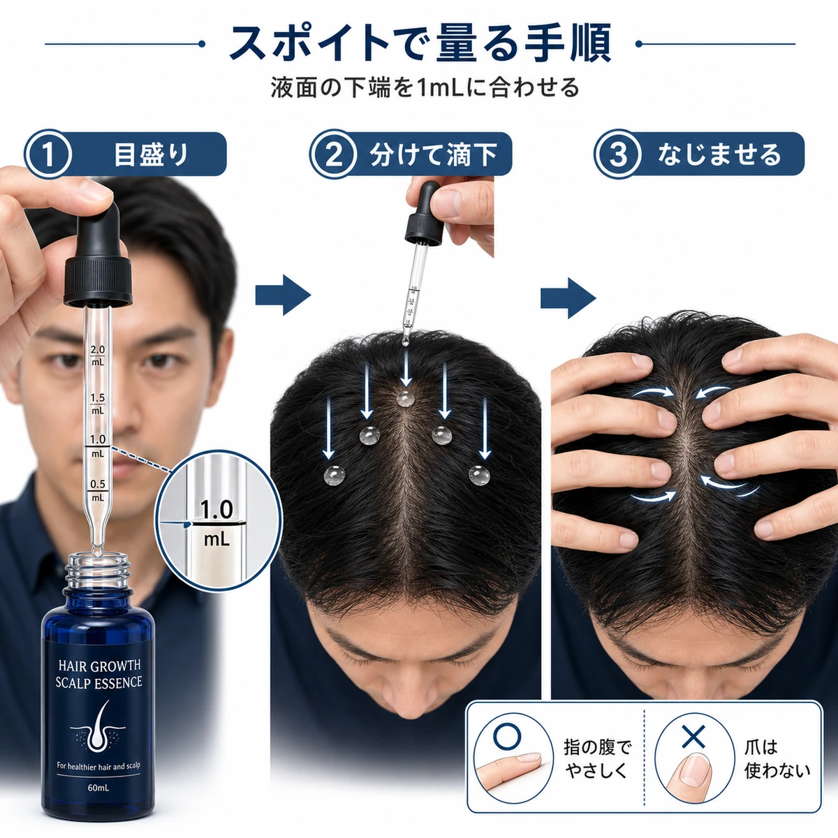 スポイトの目盛りを1mLに合わせて頭皮へ分けて滴下しなじませるまでの3手順を示した医療イラスト