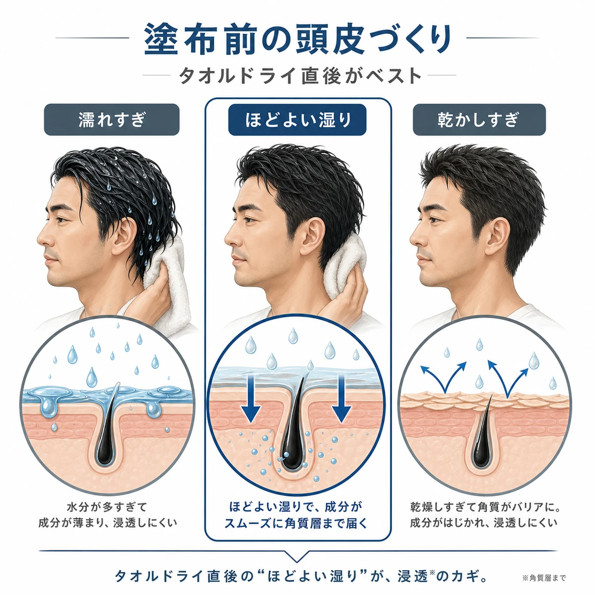 頭皮の水分量による育毛剤の浸透しやすさをほどよい湿り気を中心に3段階で比べた医療イラスト