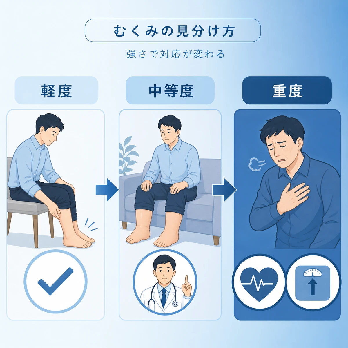 むくみの程度を軽度から重度まで段階的に見分けるポイントを表した医療イラスト