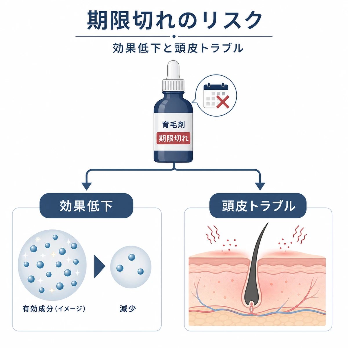 期限切れの育毛剤による効果低下と頭皮トラブルのリスクを表した医療イラスト