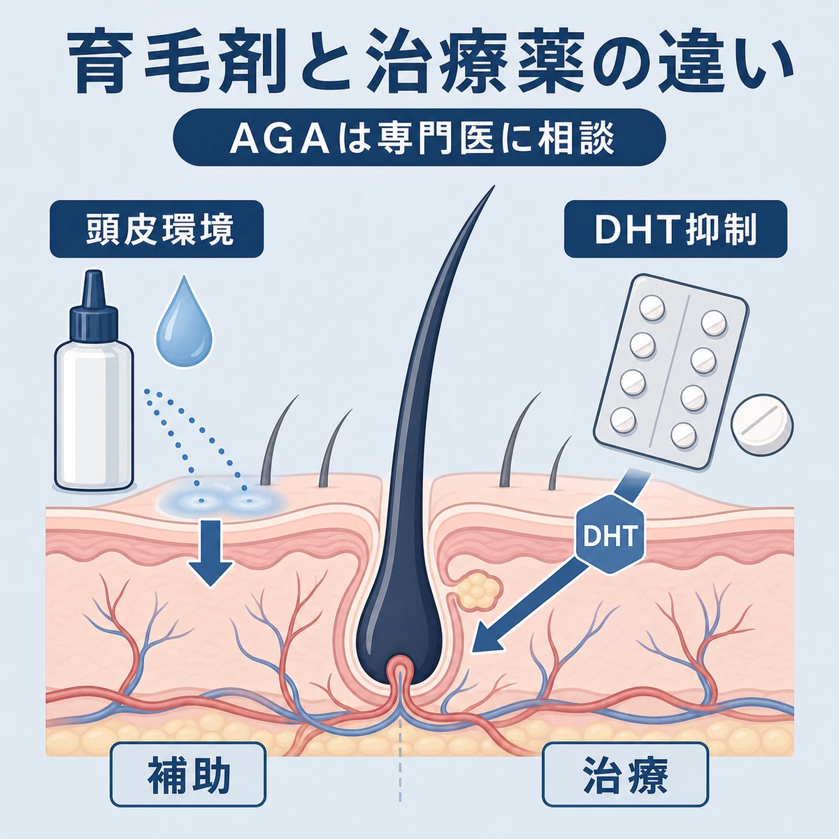 育毛剤とAGA治療薬の作用点の違いを毛根の断面で表した医療イラスト