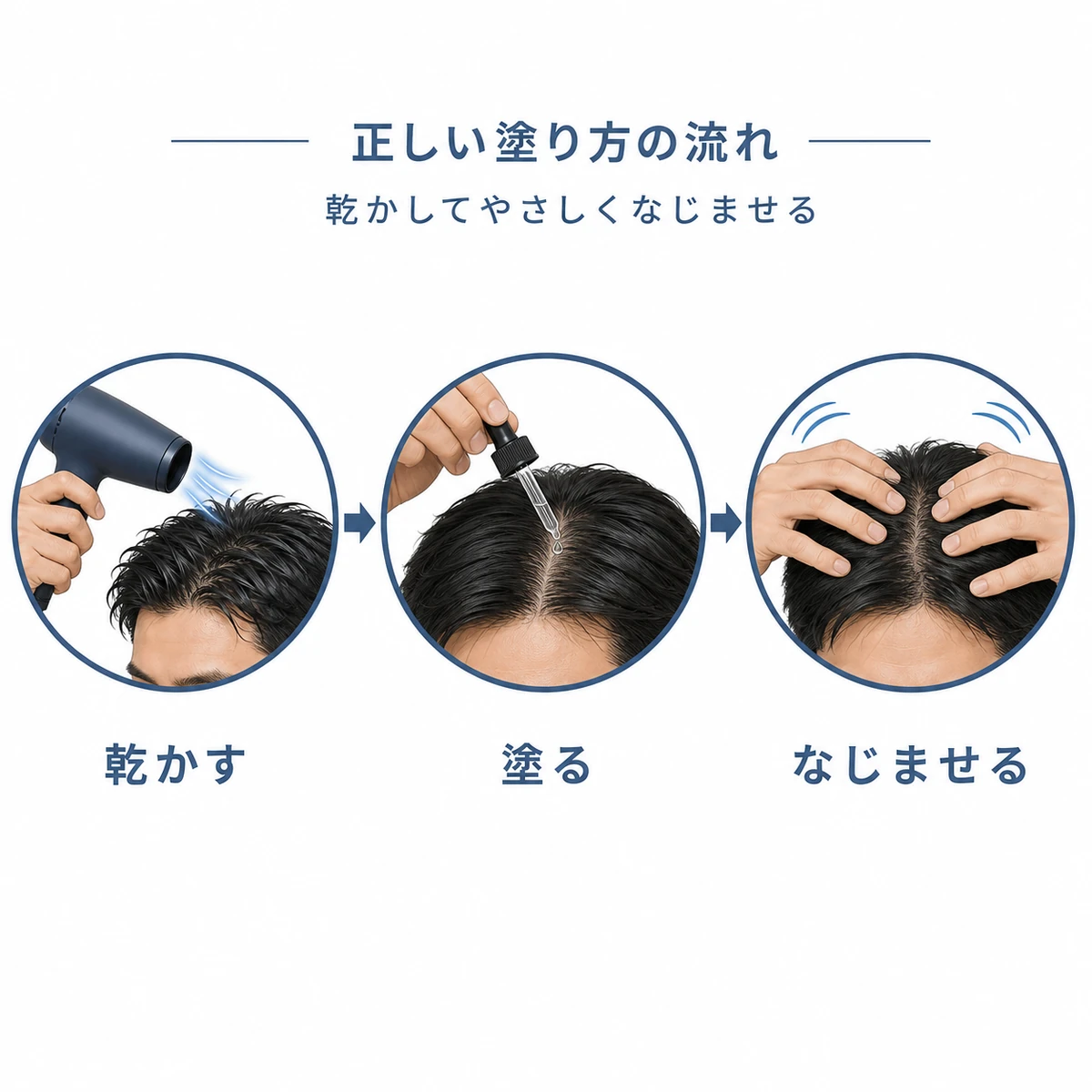 育毛剤を乾かしてから塗りなじませる正しい手順を表した医療イラスト