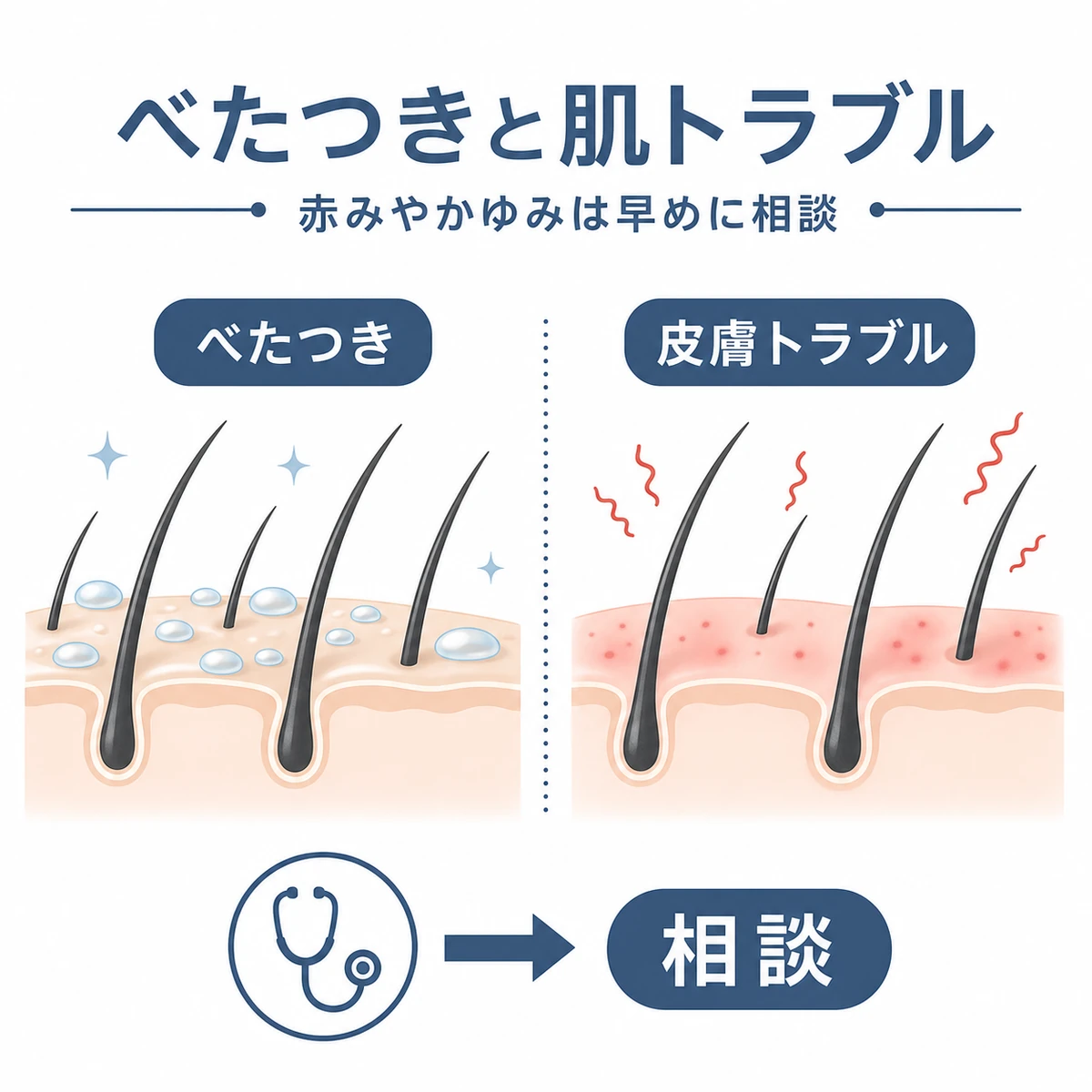 育毛剤のべたつきと頭皮の接触皮膚炎の違いを左右で比べた医療イラスト