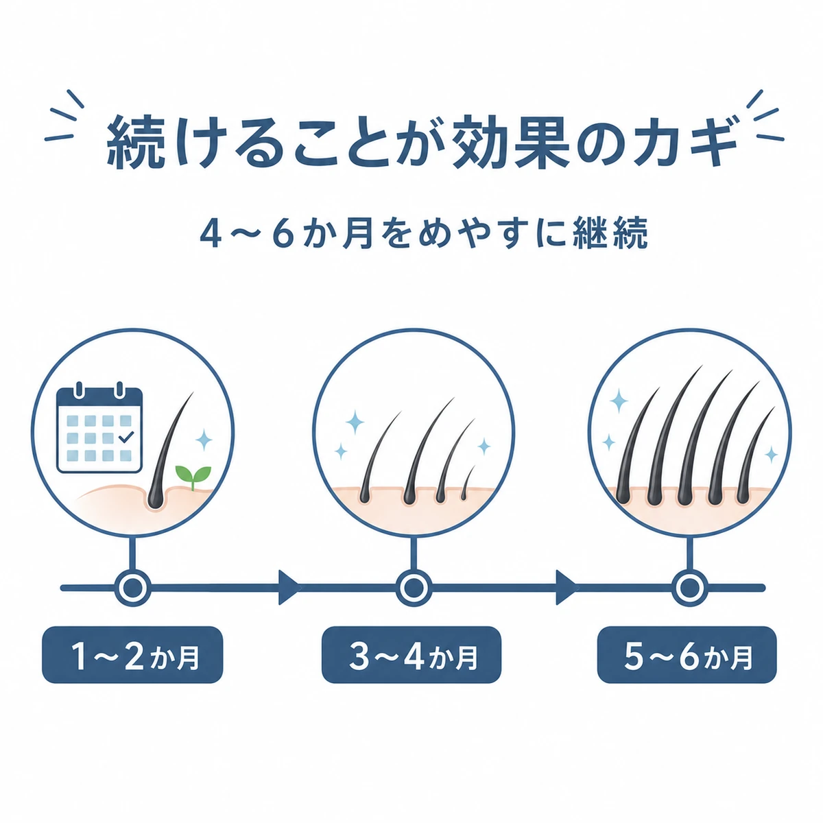 育毛剤の効果実感までの経過を1〜6か月の時間軸で段階的に示した医療イラスト