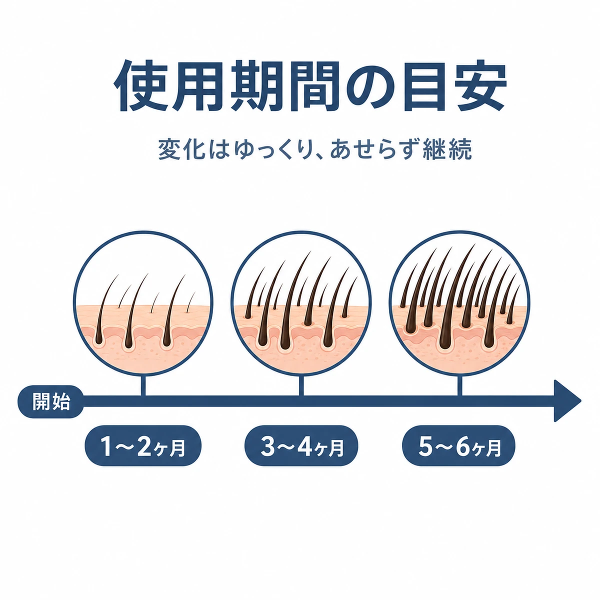 育毛剤の効果が現れるまでの使用期間を左から右への時間軸で表した医療イラスト