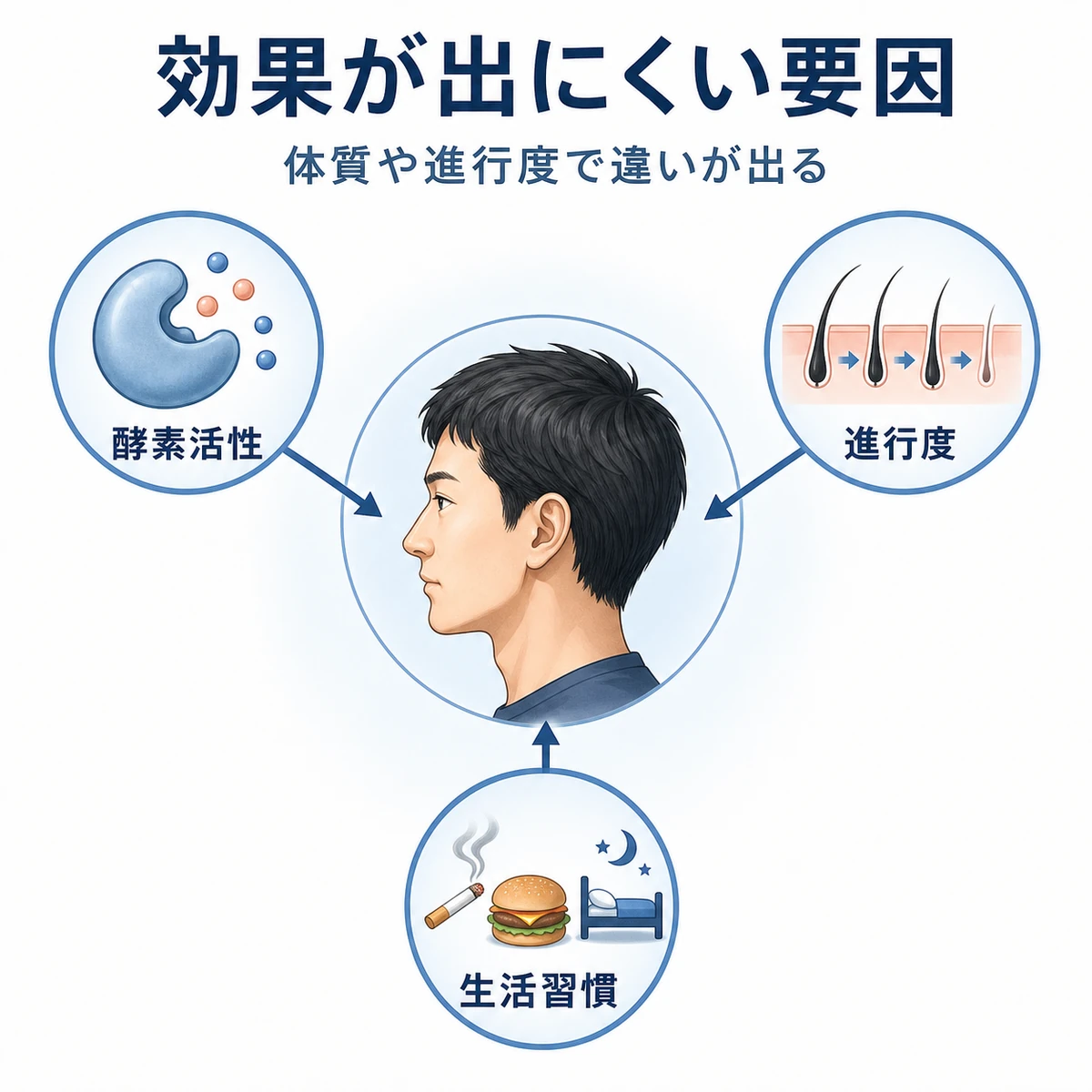 育毛剤の効果が出にくい男性に共通する要因を頭部を中心とした相関図で表した医療イラスト