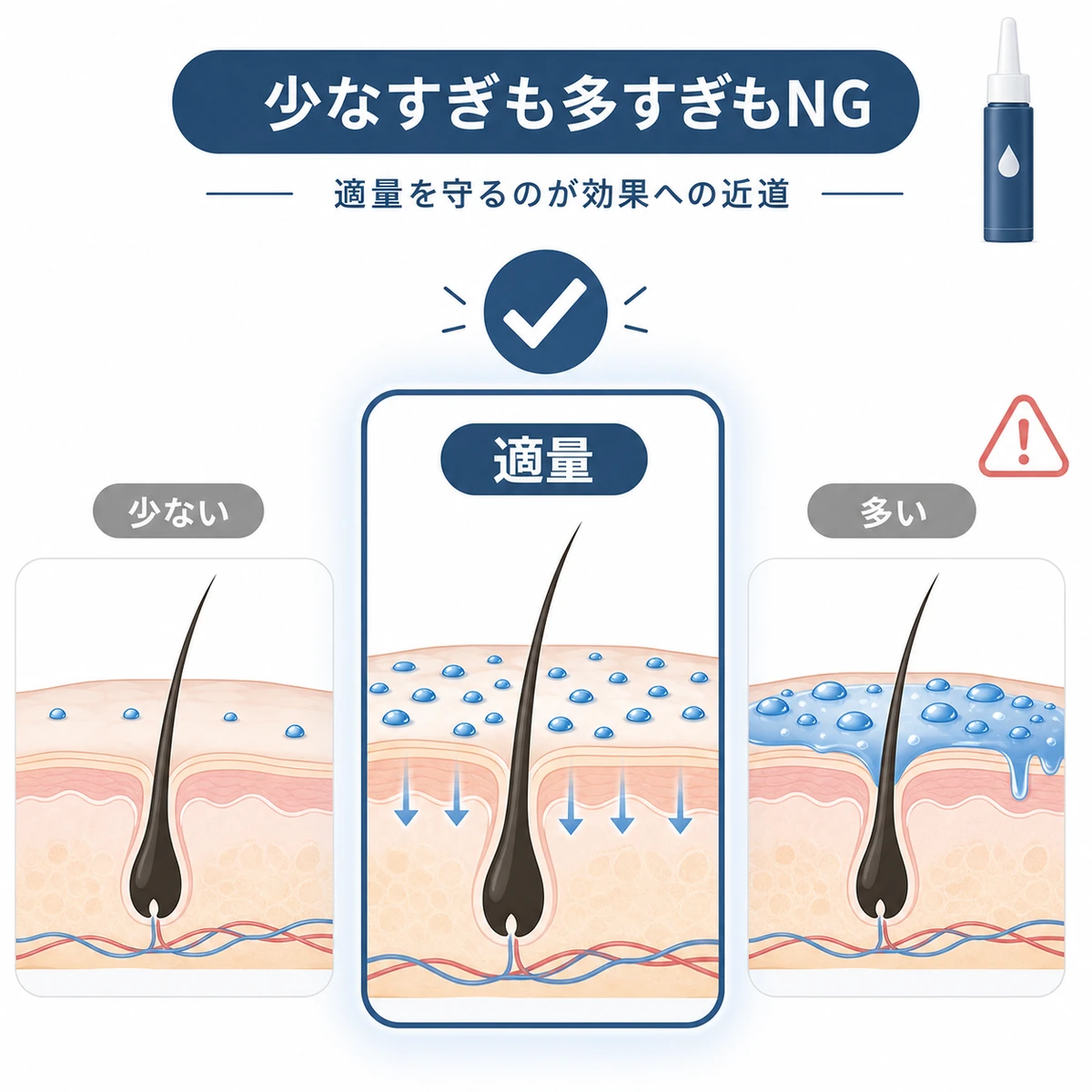 少なすぎ・適量・多すぎの3段階を並べて中央の適量が最適だと表した育毛剤の医療イラスト