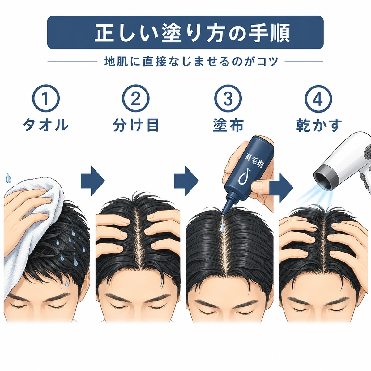 洗髪後のタオルドライから分け目・塗布・乾燥まで正しい塗り方の手順を表した育毛剤の医療イラスト