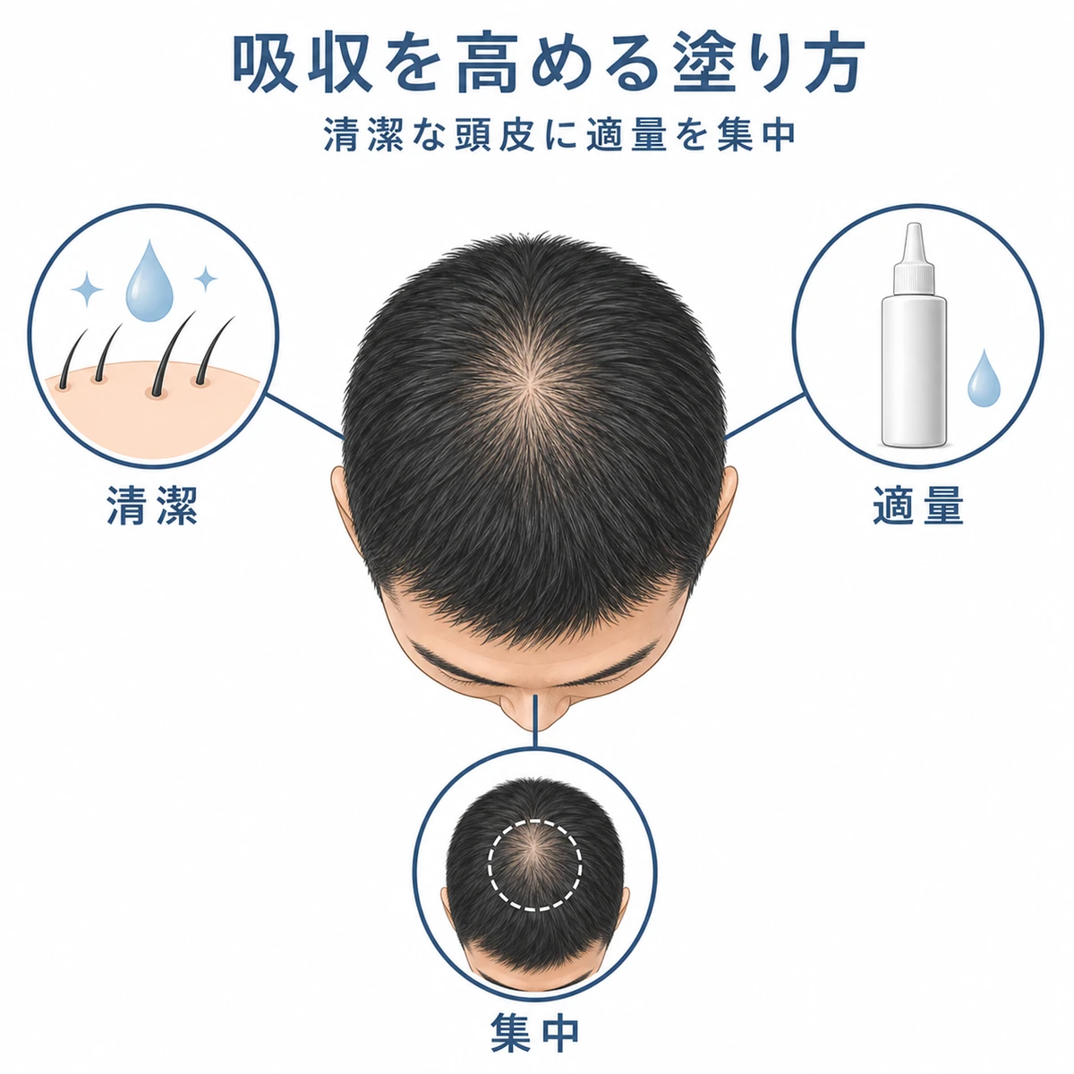 清潔な頭皮に適量を集中して塗る育毛剤の正しい塗り方を表した医療イラスト