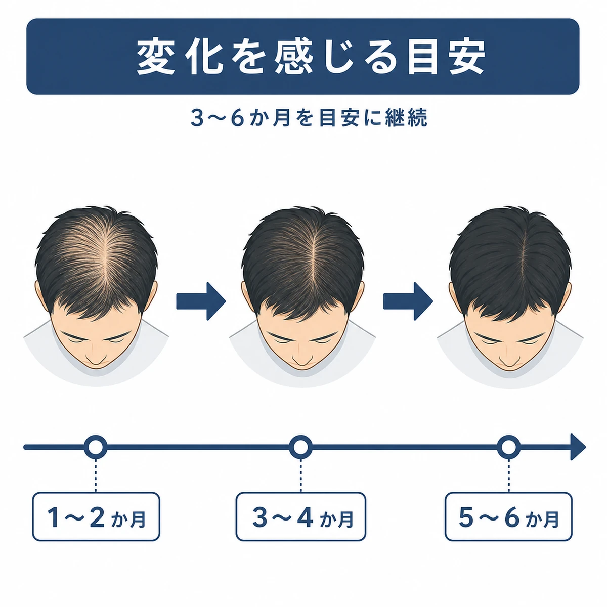 育毛剤の使用月数ごとに変化の目安を時間軸で表した男性向けイラスト