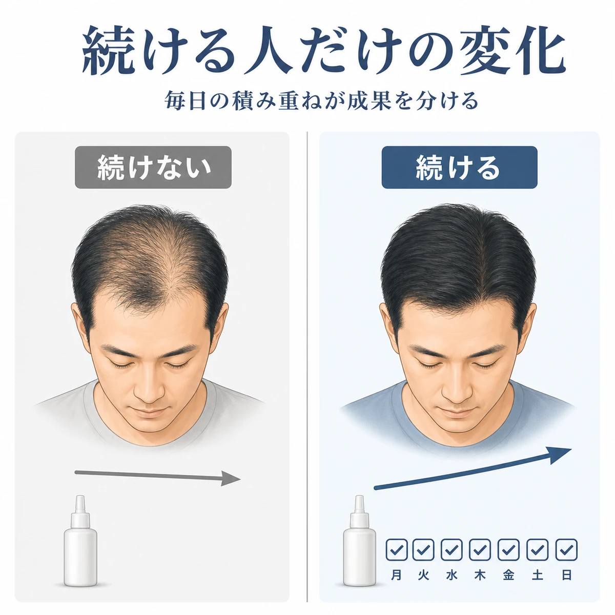 育毛剤を続けた人と途中でやめた人の頭皮の違いを左右で対比した医療イラスト