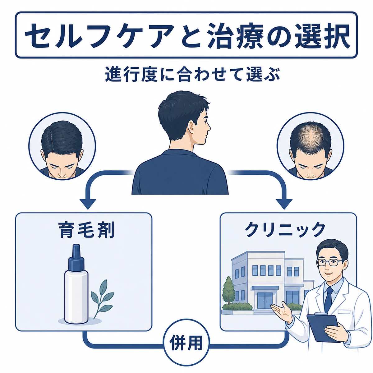 初期は育毛剤でセルフケア、進行時はクリニック治療という薄毛対策の選び方を表した医療イラスト