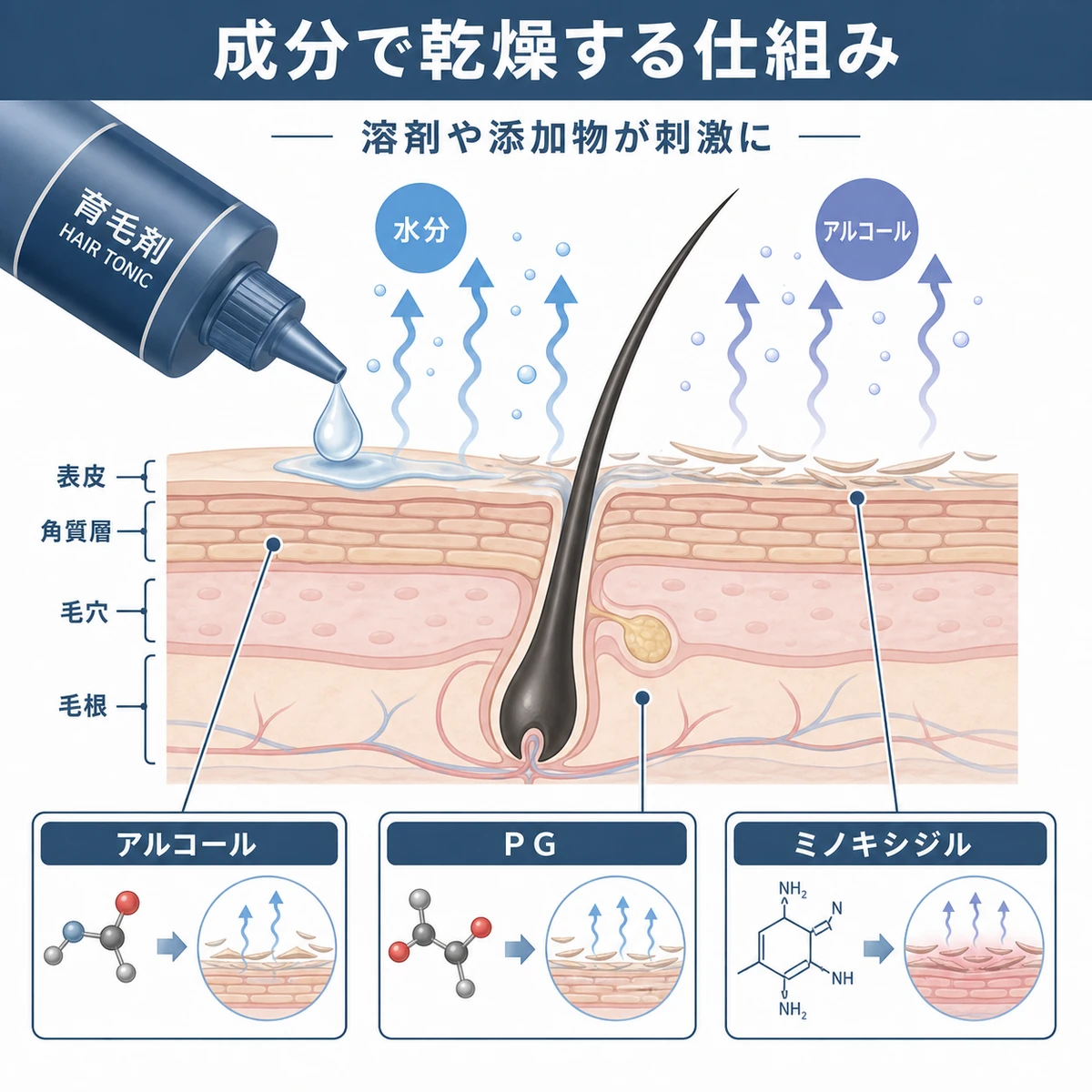 育毛剤の溶剤が頭皮の水分を奪い乾燥させる仕組みを頭皮断面図で表した医療イラスト