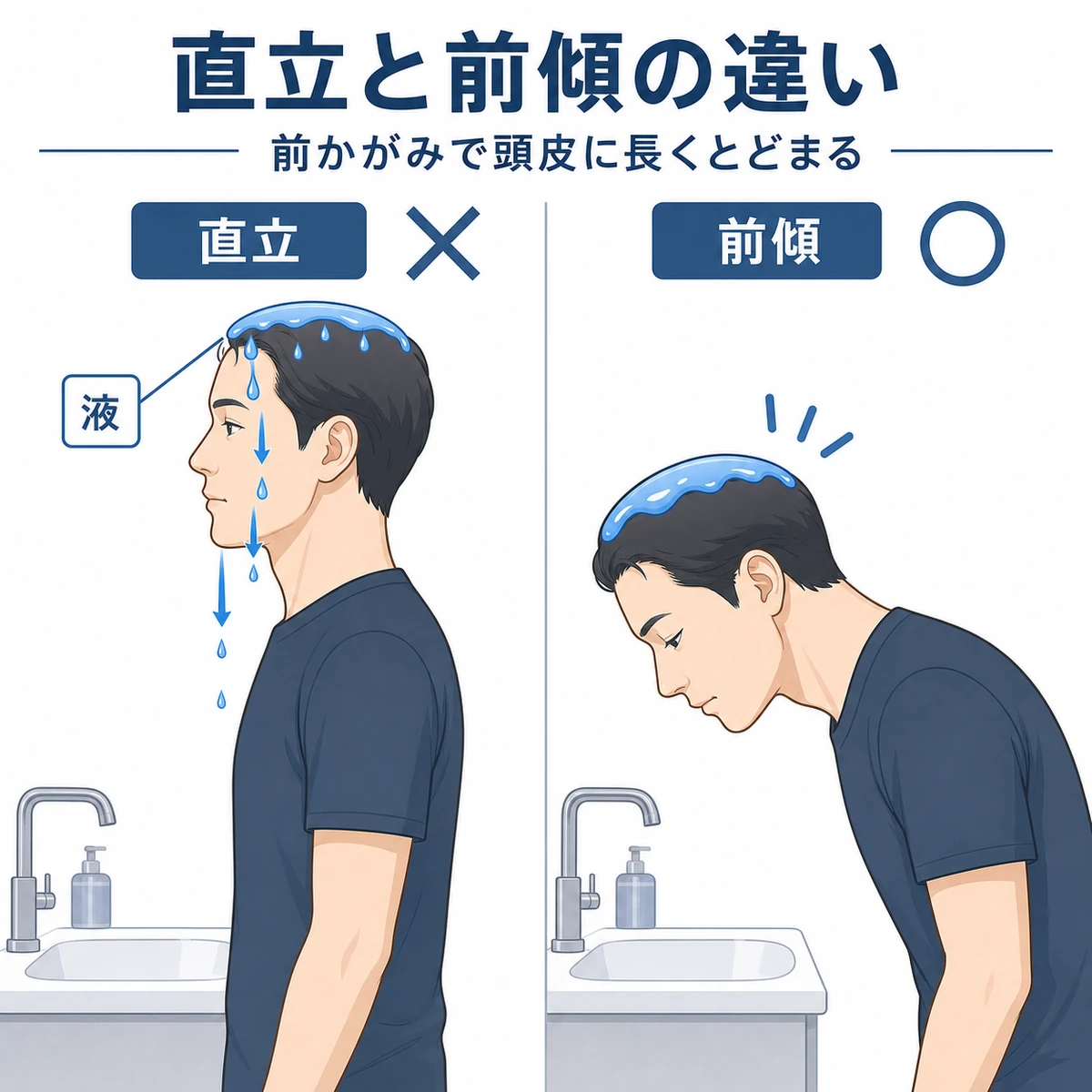 直立と前傾で育毛剤の液垂れ方が変わる様子を比べた医療イラスト