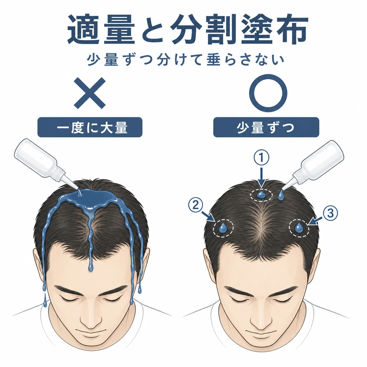 一度に大量と少量ずつの分割塗布で液垂れの差を比べた育毛剤イラスト