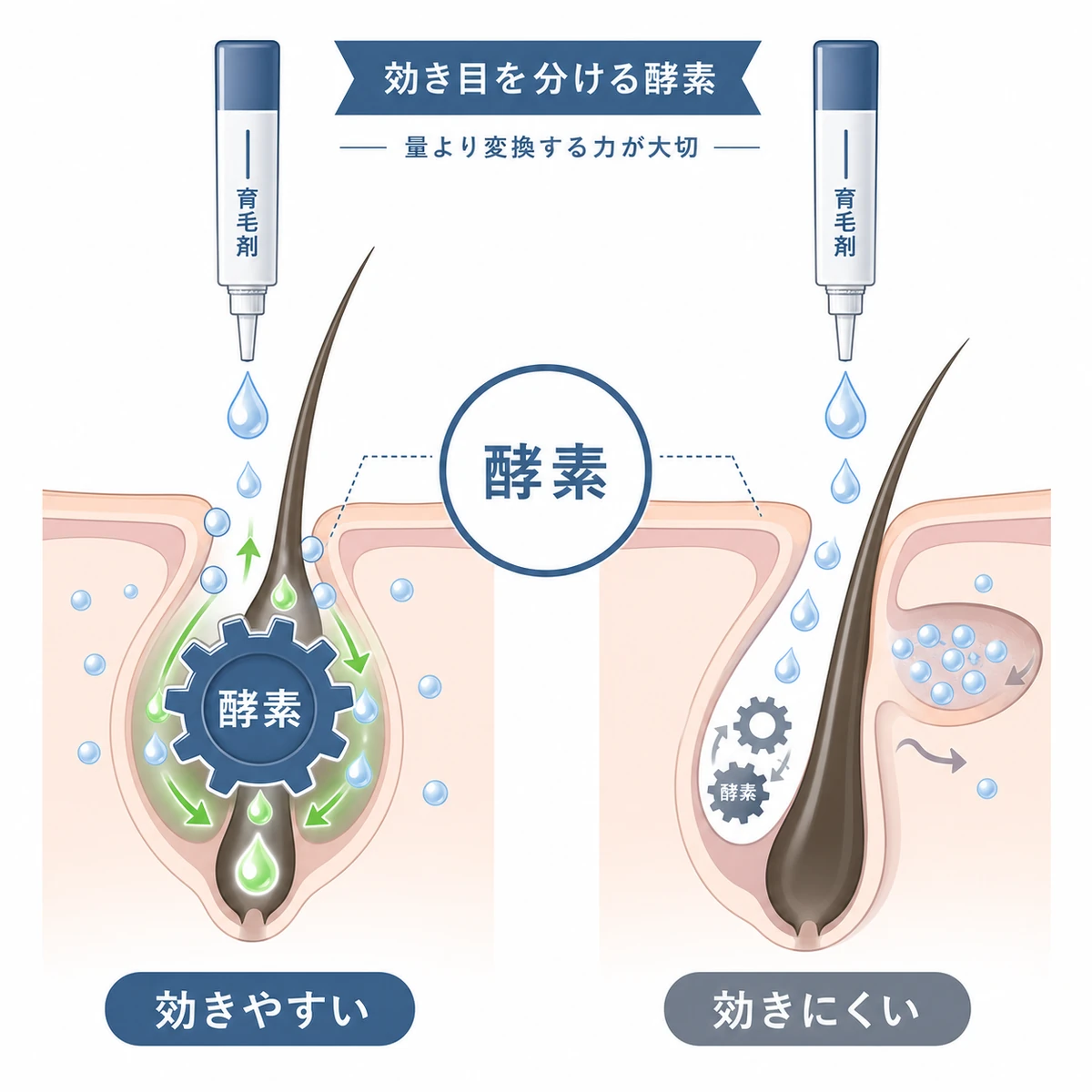 毛包の酵素の働きの差で育毛剤の効き目が分かれる様子を表した医療イラスト