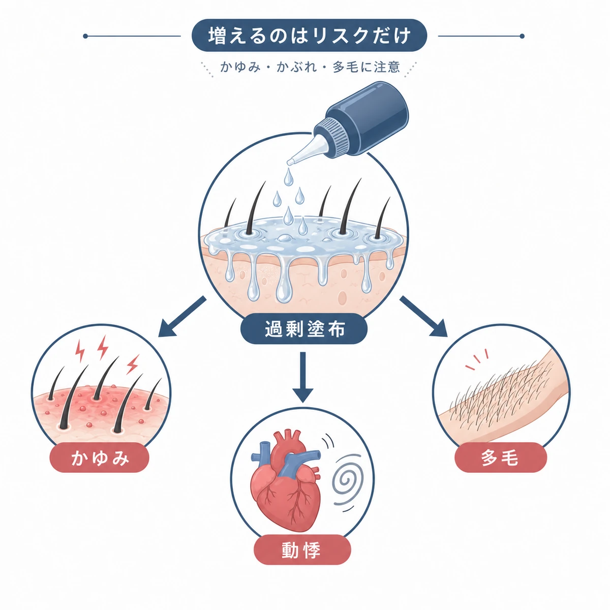 育毛剤の過剰使用で副作用リスクが高まる関係を表した医療イラスト