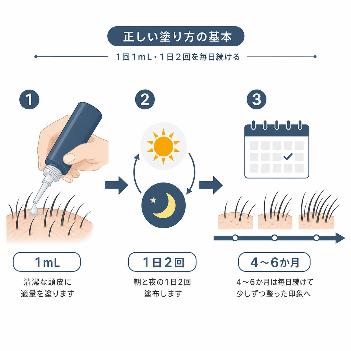育毛剤を1回1mL・1日2回で継続する正しい使い方の流れを表した医療イラスト