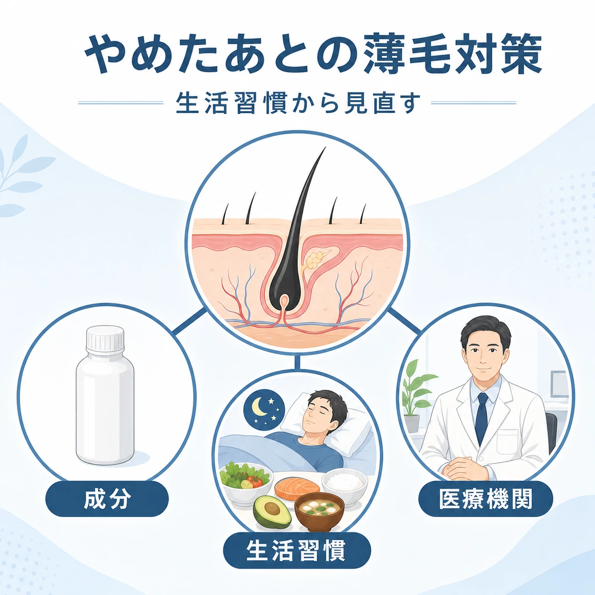 育毛剤の成分と定期購入をやめたあとの薄毛対策を表した医療イラスト