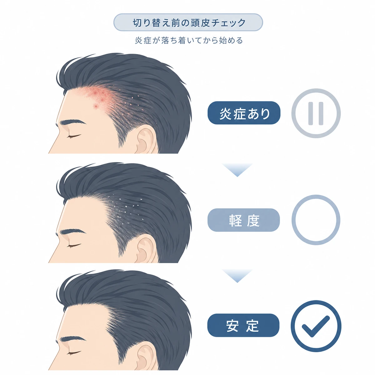 頭皮の炎症の有無で切り替えの可否が変わることを表した医療イラスト