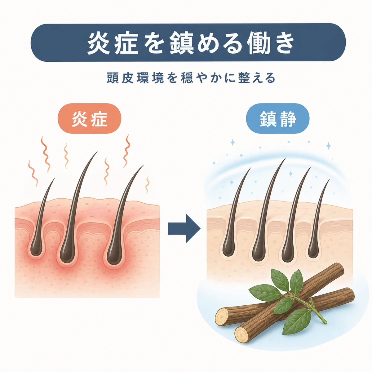 グリチルリチン酸が頭皮の炎症を鎮めて環境を整える様子を表した医療イラスト