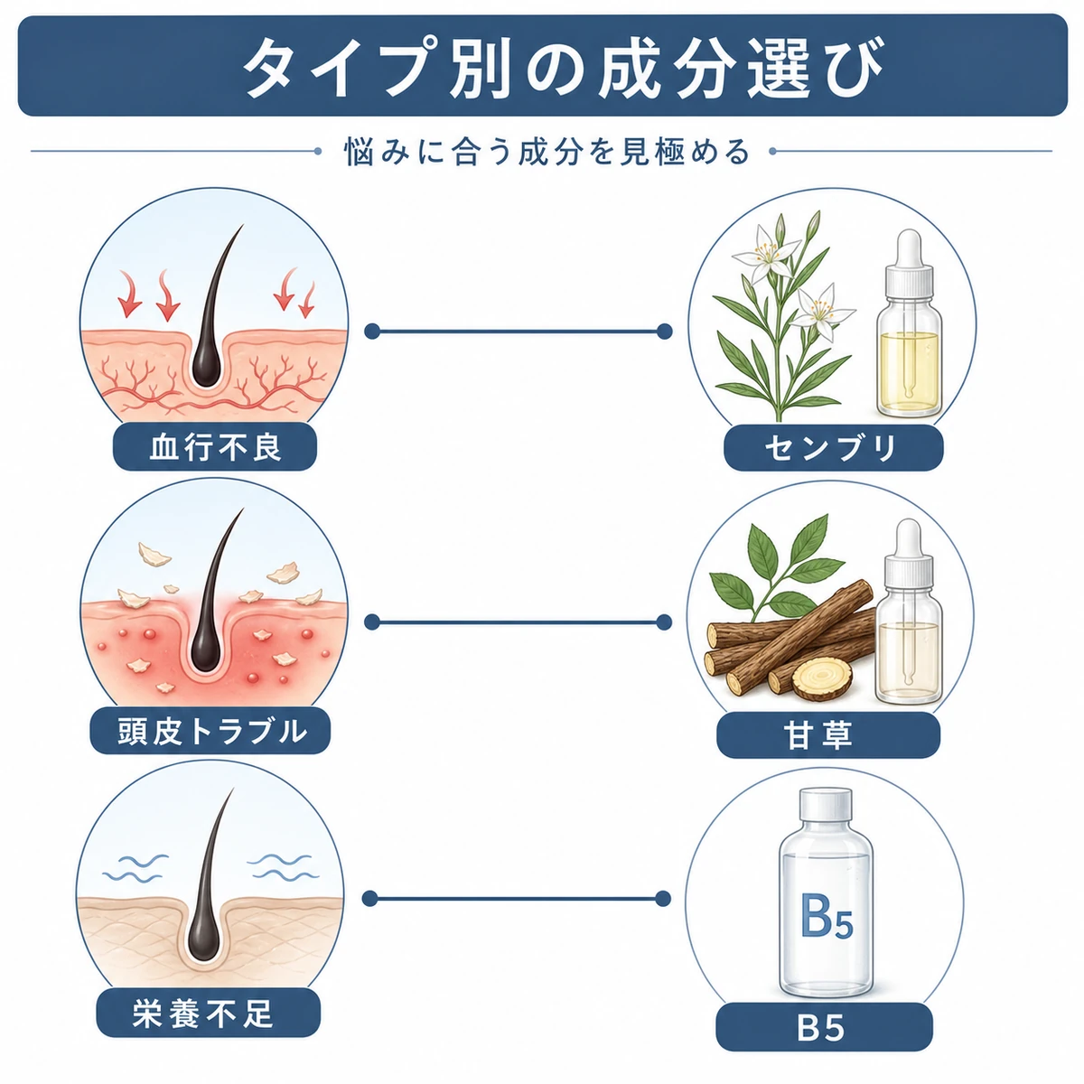 薄毛タイプと相性の良い有効成分の組み合わせを線でつないだ医療イラスト