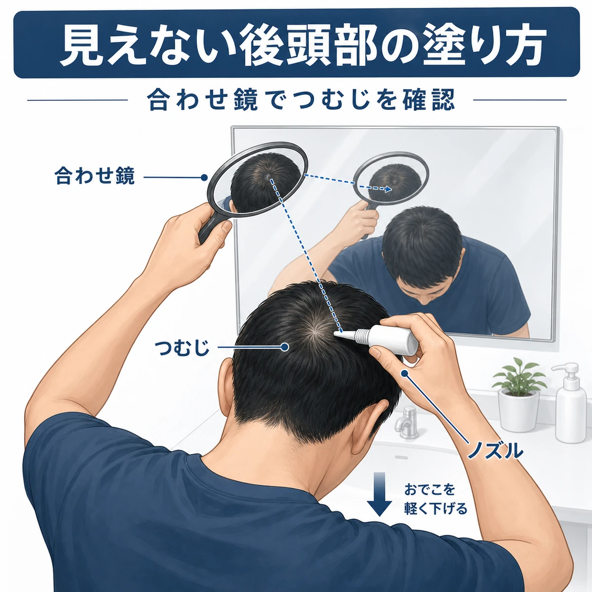 合わせ鏡で見えない後頭部のつむじを確認しながら育毛剤を塗る男性の実践テクニックを表した医療イラスト