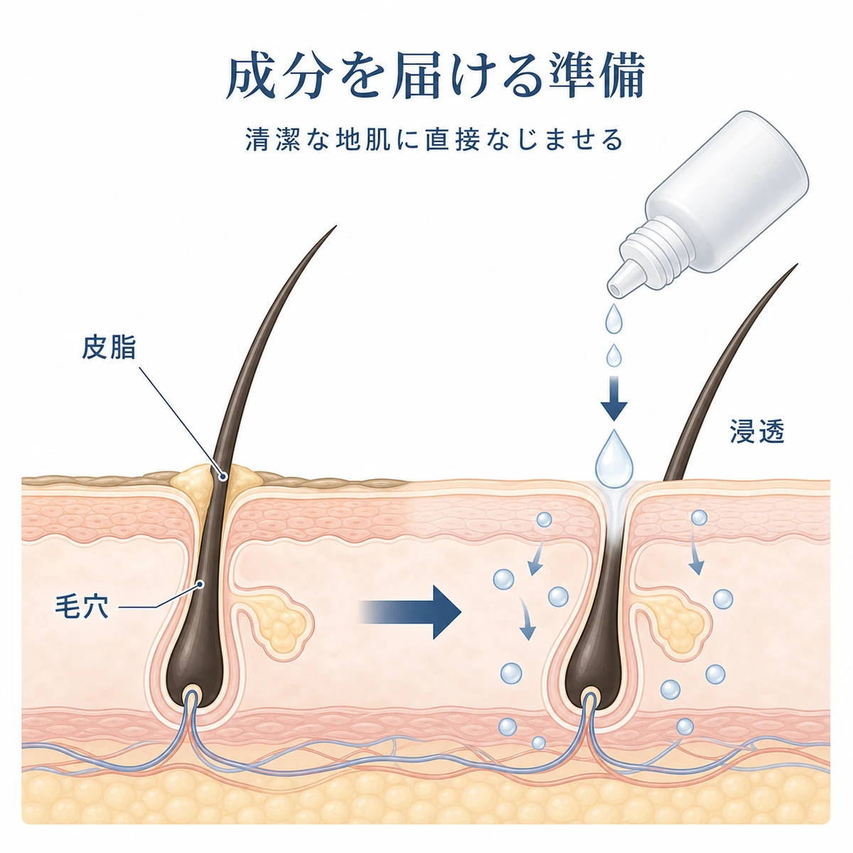 清潔で開いた毛穴に育毛剤の成分がなじむ頭皮断面のしくみを表した医療イラスト
