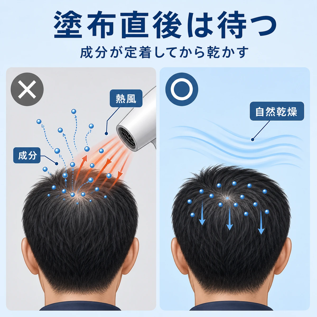 育毛剤塗布直後のドライヤーと自然乾燥で成分の残り方が変わる様子を比べた医療イラスト