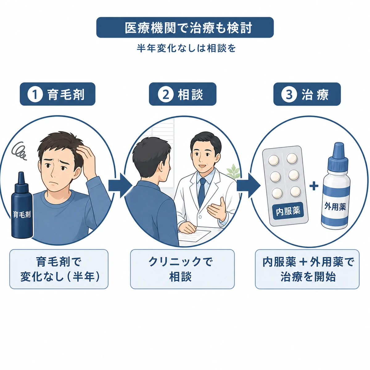 育毛剤から医療機関の治療へ進む薄毛対策の流れを表した医療イラスト