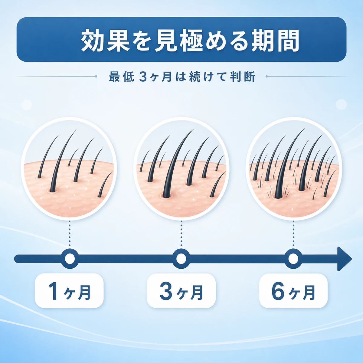 1ヶ月から6ヶ月までの頭皮と髪の変化の段階を表した解説イラスト